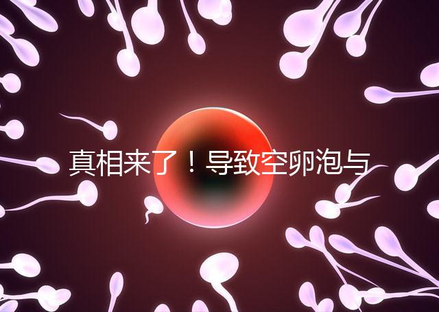 真相來了!導致空卵泡與多囊卵巢有關,區別在于以下四點,多研究