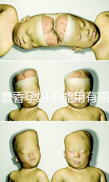 白麝香孕婦不能用有原因，流產(chǎn)、早產(chǎn)…這些危害不得不知