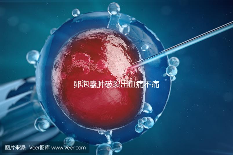 卵泡囊腫破裂出血痛不痛？經(jīng)歷過的姐妹們給出回應(yīng)