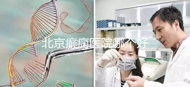 北京癲癇醫院哪個好