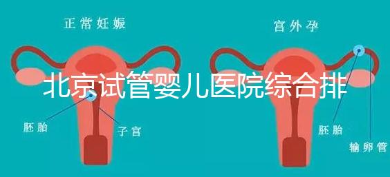 北京試管嬰兒醫(yī)院綜合排名比較完美的有哪幾個(gè)