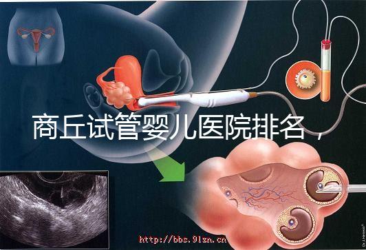 商丘試管嬰兒醫(yī)院排名，附3家公立機(jī)構(gòu)助孕成功率和費(fèi)用
