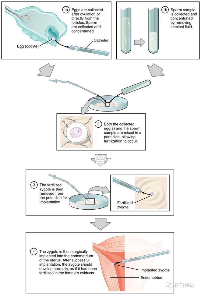 國內(nèi)首起試管嬰兒案例，法律竟難以給患者維權(quán)