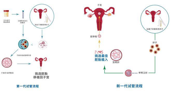 了解二代試管嬰兒:技術(shù)原理與優(yōu)勢(shì)解析