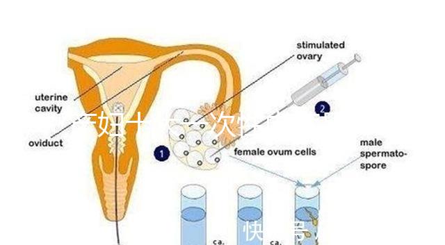 產(chǎn)婦十大一次性內(nèi)褲品牌排行揭曉,全棉時代質(zhì)量如何看這