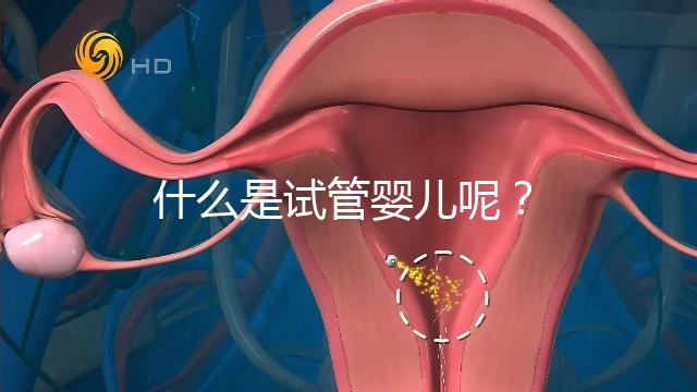 什么是試管嬰兒呢？