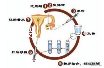 代試管嬰兒和第二代試管嬰兒的區(qū)別,基因篩查技術(shù)!