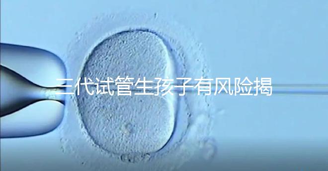 三代試管生孩子有風險揭秘嗎？嬰兒會有問題嗎？