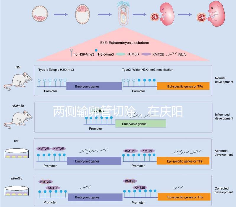兩側輸卵管切除，在慶陽有醫院能做試管嬰兒嗎？