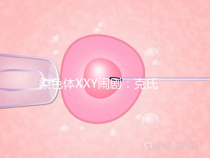 染色體XXY鬧劇：克氏綜合征，帶你走進“第三性別”群體