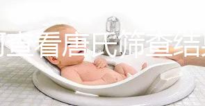 如何查看唐氏篩查結果，珠海醫(yī)院價格二百四起