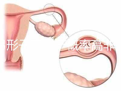 弓形子宮流產概率高非個例！罪魁禍首是這個原因