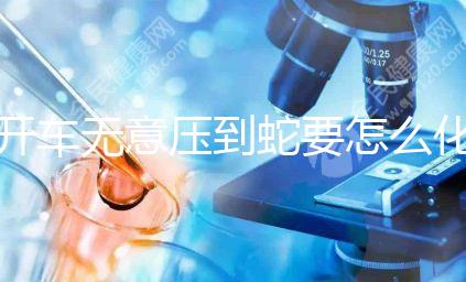 開車無意壓到蛇要怎么化解進來瞧，要不要報警一目了然