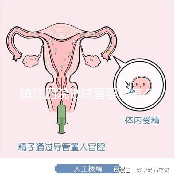 鎮江四院做試管嬰兒怎么樣？具體成功率費用介紹