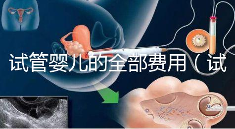 試管嬰兒的全部費(fèi)用(試管嬰兒的全部費(fèi)用大概是多少重慶安琪兒電話)