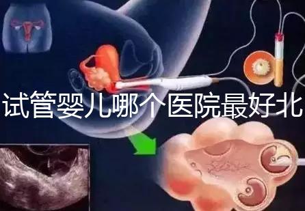 試管嬰兒哪個(gè)醫(yī)院最好北京（試管嬰兒北京哪個(gè)醫(yī)院做的好）