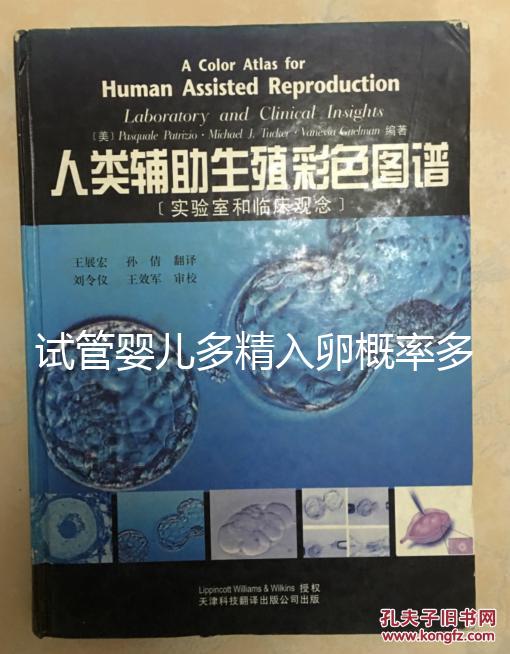 試管嬰兒多精入卵概率多少難說,比正常配對(duì)低別瞎操心