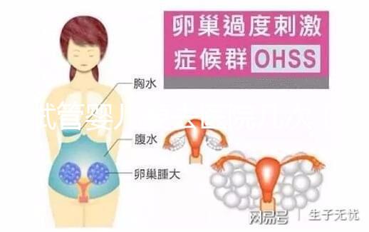 試管嬰兒要去醫(yī)院幾次(試管嬰兒要去醫(yī)院幾次?)