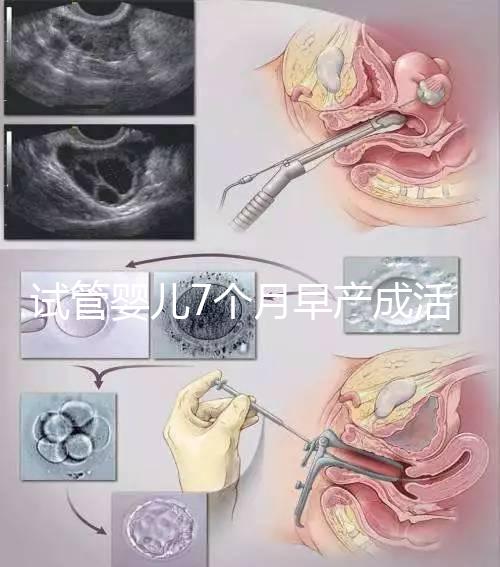 試管嬰兒7個(gè)月早產(chǎn)成活率高達(dá)80%！能不能要看身體狀況