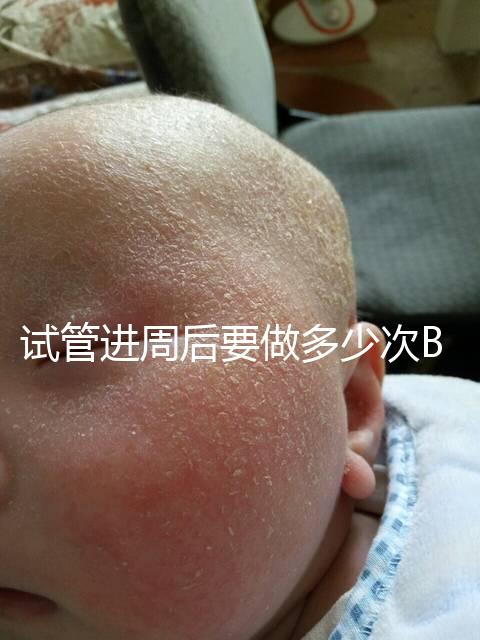 試管進周后要做多少次B超？需要檢查什么？進來看看