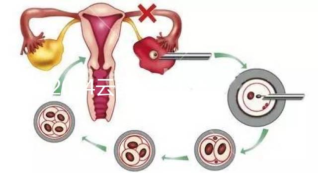 2024云南產(chǎn)假158天怎么算？新政策中，男方培育假貨